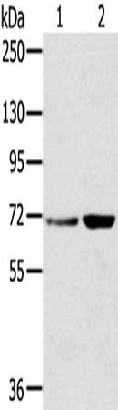 Gel: 8%SDS-PAGE, Lysate: 40 μg, Lane 1-2: Hela cells, 293T cells, Primary antibody: SNX2 Antibody(SNX2 Antibody) at dilution 1/300, Secondary antibody: Goat anti rabbit IgG at 1/8000 dilution, Exposure time: 10 secondsRabbit anti-Human SNX2 Polyclonal Antibody