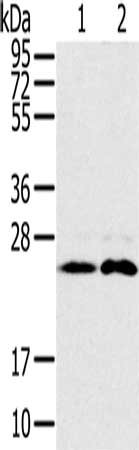 Gel: 10%SDS-PAGE, Lysate: 40 μg, Lane 1-2: Mouse brain tissue, Raji cells, Primary antibody: RAB14 Antibody(RAB14 Antibody) at dilution 1/200, Secondary antibody: Goat anti rabbit IgG at 1/8000 dilution, Exposure time: 30 secondsRabbit anti-Human RAB14 Polyclonal Antibody