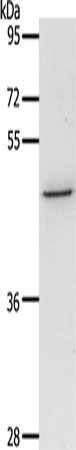 Gel: 10%SDS-PAGE, Lysate: 40 μg, Lane: SKOV3 cells, Primary antibody: CCR3 Antibody(CCR3 Antibody) at dilution 1/300, Secondary antibody: Goat anti rabbit IgG at 1/8000 dilution, Exposure time: 1 minuteRabbit anti-Human CCR3 Polyclonal Antibody