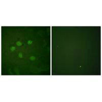 Immunofluorescence analysis of HuvEc cells, using AOS1 antibody.Rabbit anti-Human SAE1 Polyclonal Antibody