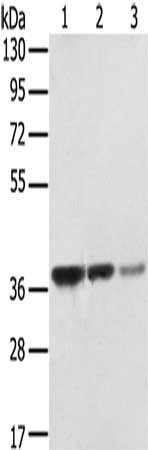 Gel: 8%SDS-PAGE, Lysate: 40 μg, Lane 1-3: MCF7 cells, A172 cells, hepg2 cells, Primary antibody: STX16 Antibody(STX16 Antibody) at dilution 1/400, Secondary antibody: Goat anti rabbit IgG at 1/8000 dilution, Exposure time: 5 secondsRabbit anti-Human STX16 Polyclonal Antibody