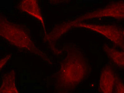 Immunofluorescence staining of methanol-fixed Hela cells using NFkB-p65(Phospho-Ser529) Antibody.Rabbit anti-Human RELA Polyclonal Antibody