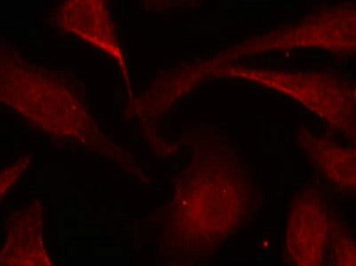 Immunofluorescence staining of methanol-fixed Hela cells using NFkB-p65(Phospho-Ser529) Antibody.Rabbit anti-Human RELA Polyclonal Antibody