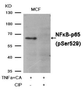 Western blot analysis of extracts from MCF cells, treated with TNFa+CA or calf intestinal phosphatase (CIP), using NFκB-p65 (Phospho-Ser529) Antibody.Rabbit anti-Human RELA Polyclonal Antibody