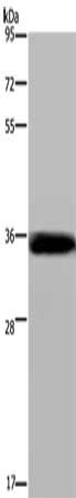 Gel: 8%SDS-PAGE, Lysate: 40 μg, Lane: Mouse lung tissue, Primary antibody: LIMS1 Antibody(LIMS1 Antibody) at dilution 1/200, Secondary antibody: Goat anti rabbit IgG at 1/8000 dilution, Exposure time: 3 minutes