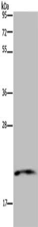 Gel: 10%SDS-PAGE, Lysate: 40 μg, Lane: 293T cells, Primary antibody: NDUFA8 Antibody(NDUFA8 Antibody) at dilution 1/300, Secondary antibody: Goat anti rabbit IgG at 1/8000 dilution, Exposure time: 5 minutesRabbit anti-Human NDUFA8 Polyclonal Antibody