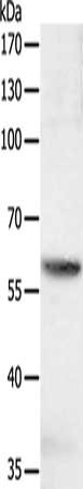 Gel: 10%SDS-PAGE, Lysate: 40 μg, Lane: jurkat cells, Primary antibody: SOCS6 Antibody(SOCS6 Antibody) at dilution 1/600, Secondary antibody: Goat anti rabbit IgG at 1/8000 dilution, Exposure time: 1 secondRabbit anti-Human SOCS6 Polyclonal Antibody