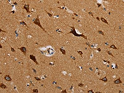 The image on the left is immunohistochemistry of paraffin-embedded Human brain  tissue using MRPL39 Antibody(MRPL39 Antibody) at dilution 1/45, on the right is treated with fusion protein. (Original magnification: ×200)Rabbit anti-Human MRPL39 Polyclonal Antibody