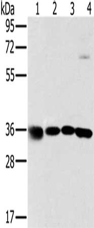 Gel: 8%SDS-PAGE, Lysate: 40 μg, Lane 1-4: 293T cells, K562 cells, 231 cells, hela cells, Primary antibody: MRPL39 Antibody(MRPL39 Antibody) at dilution 1/600, Secondary antibody: Goat anti rabbit IgG at 1/8000 dilution, Exposure time: 2 secondsRabbit anti-Human MRPL39 Polyclonal Antibody