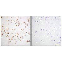 Immunohistochemistry analysis of paraffin-embedded human brain tissue using Catenin-δ1 (Ab-228) antibody.Rabbit anti-Human CTNND1 Polyclonal Antibody