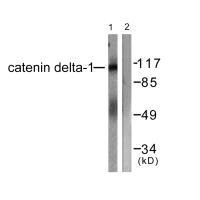 Western blot analysis of extracts from HuvEc cells, using Catenin-δ1 (Ab-228) antibody.Rabbit anti-Human CTNND1 Polyclonal Antibody