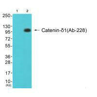 Western blot analysis of extracts from 293 cells (Lane 2), using Catenin-δ1 (Ab-228) antiobdy. The lane on the left is treated with synthesized peptide.Rabbit anti-Human CTNND1 Polyclonal Antibody