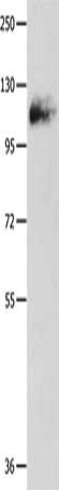 Gel: 10%SDS-PAGE, Lysate: 60 μg, Lane: Mouse lung tissue, Primary antibody: AMPH Antibody(AMPH Antibody) at dilution 1/500, Secondary antibody: Goat anti rabbit IgG at 1/8000 dilution, Exposure time: 1 minuteRabbit anti-Human AMPH Polyclonal Antibody