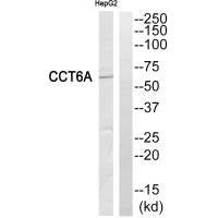 Western blot analysis of extracts from HepG2 cells, using CCT6A antibody.Rabbit anti-Human CCT6A Polyclonal Antibody