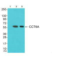 Western blot analysis of extracts from cos-7 cells (Lane 2) and 293 cells (Lane 3), using CCT6A antiobdy. The lane on the left is treated with synthesized peptide.Rabbit anti-Human CCT6A Polyclonal Antibody