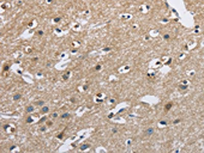 The image on the left is immunohistochemistry of paraffin-embedded Human brain  tissue using CAB39L Antibody(CAB39L Antibody) at dilution 1/40, on the right is treated with fusion protein. (Original magnification: ×200)