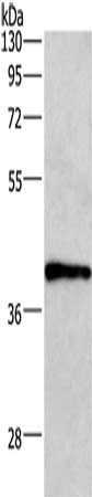 Gel: 8%SDS-PAGE, Lysate: 40 μg, Lane: A549 cells, Primary antibody: WNT3A Antibody(WNT3A Antibody) at dilution 1/400, Secondary antibody: Goat anti rabbit IgG at 1/8000 dilution, Exposure time: 2 minutesRabbit anti-Human WNT3A Polyclonal Antibody