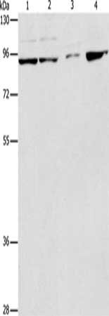 Gel: 8%SDS-PAGE, Lysate: 40 μg, Lane 1-4: Raji cells, A549 cells, A431 cells, K562 cells, Primary antibody: PIK3R2 Antibody(PIK3R2 Antibody) at dilution 1/233, Secondary antibody: Goat anti rabbit IgG at 1/8000 dilution, Exposure time: 2 minutesRabbit anti-Human PIK3R2 Polyclonal Antibody