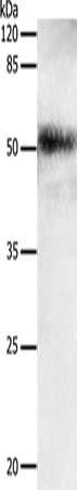 Gel: 10%SDS-PAGE, Lysate: 30 μg, Lane: Human lung cancer tissue, Primary antibody: EDA Antibody(EDA Antibody) at dilution 1/650, Secondary antibody: Goat anti rabbit IgG at 1/8000 dilution, Exposure time: 5 minutesRabbit anti-Human EDA Polyclonal Antibody