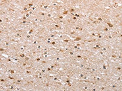 The image on the left is immunohistochemistry of paraffin-embedded Human brain  tissue using CANX Antibody(CANX Antibody) at dilution 1/50, on the right is treated with fusion protein. (Original magnification: ×200)
