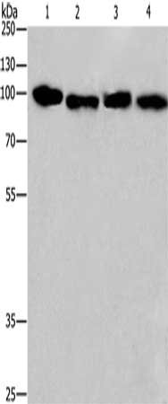 Gel: 8%SDS-PAGE, Lysate: 40 μg, Lane 1-4: Hela cells, 231 cells, human placenta tissue, Human carcinoma of sigmoid tissue, Primary antibody: CANX Antibody(CANX Antibody) at dilution 1/615, Secondary antibody: Goat anti rabbit IgG at 1/8000 dilution, Exposure time: 20 seconds