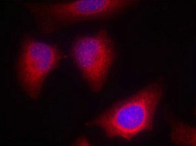 Immunofluorescence staining of methanol-fixed Hela cells using PKCth(Ab-676) Antibody.Rabbit anti-Human PRKCQ Polyclonal Antibody