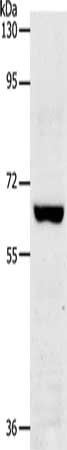 Gel: 8%SDS-PAGE, Lysate: 40 μg, Lane: Jurkat cells, Primary antibody: TRAF7 Antibody(TRAF7 Antibody) at dilution 1/300, Secondary antibody: Goat anti rabbit IgG at 1/8000 dilution, Exposure time: 2 minutesRabbit anti-Human TRAF7 Polyclonal Antibody