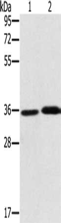 Gel: 10%SDS-PAGE, Lysate: 40 μg, Lane 1-2: A549 cells, mouse liver tissue, Primary antibody: PHYH Antibody(PHYH Antibody) at dilution 1/300, Secondary antibody: Goat anti rabbit IgG at 1/8000 dilution, Exposure time: 1 minuteRabbit anti-Human PHYH Polyclonal Antibody