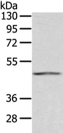 Gel: 8%SDS-PAGE, Lysate: 80 μg, Lane: Humna placenta tissue, Primary antibody: AGPAT9 Antibody(AGPAT9 Antibody) at dilution 1/200 dilution, Secondary antibody: Goat anti rabbit IgG at 1/8000 dilution, Exposure time: 15 secondsRabbit anti-Human AGPAT9 Polyclonal Antibody