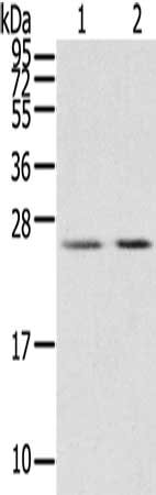Gel: 12%SDS-PAGE, Lysate: 40 μg, Lane 1-2: Human breast infiltrative duct tissue, Human placenta tissue, Primary antibody: MIG7 Antibody(MIG7   Antibody) at dilution 1/200, Secondary antibody: Goat anti rabbit IgG at 1/8000 dilution, Exposure time: 15 seconds