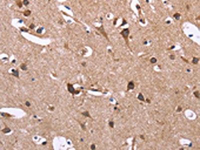 The image on the left is immunohistochemistry of paraffin-embedded Human brain tissue using SERPINA1 Antibody(SERPINA1 Antibody) at dilution 1/30, on the right is treated with synthetic peptide. (Original magnification: ×200)