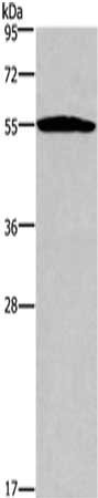 Gel: 8%SDS-PAGE,Lysate: 40 μg,,Primary antibody: SERPINA1 Antibody(SERPINA1 Antibody) at dilution 1/250 dilution,Secondary antibody: Goat anti rabbit IgG at 1/8000 dilution,Exposure time: 20 seconds