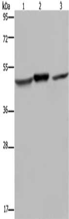 Gel: 8%SDS-PAGE, Lysate: 40 μg, Lane 1-3: Mouse heart tissue, Mouse brain tissue, Jurkat cells, Primary antibody: NDUFS2 Antibody(NDUFS2 Antibody) at dilution 1/400, Secondary antibody: Goat anti rabbit IgG at 1/8000 dilution, Exposure time: 20 secondsRabbit anti-Human NDUFS2 Polyclonal Antibody