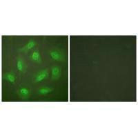 Immunofluorescence analysis of HeLa cells, treated with Forskolin (40nM, 30mins), using JAB1 antibody.Rabbit anti-Human COPS3 Polyclonal Antibody
