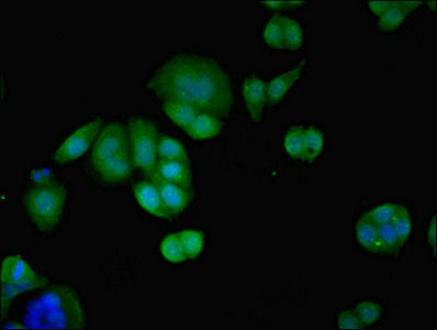 Immunofluorescent analysis of PC-3 cells using PID1 Antibody at dilution of 1:100 and Alexa Fluor 488-congugated AffiniPure Goat Anti-Rabbit IgG(H+L)Rabbit anti-Human PID1 Polyclonal Antibody