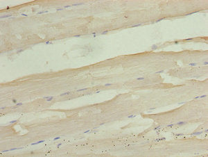 Immunohistochemistry of paraffin-embedded human skeletal muscle tissue using the antibody at dilution of 1:100Rabbit anti-Human PID1 Polyclonal Antibody