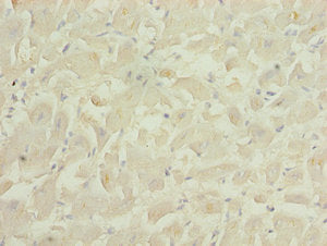 Immunohistochemistry of paraffin-embedded human heart tissue using PID1 Antibody at dilution of 1:100Rabbit anti-Human PID1 Polyclonal Antibody