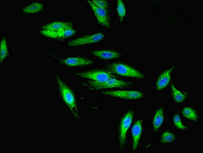Immunofluorescent analysis of Hela cells using ZFYVE16 Antibody at dilution of 1:100 and Alexa Fluor 488-congugated AffiniPure Goat Anti-Rabbit IgG(H+L)Rabbit anti-Human ZFYVE16 Polyclonal Antibody