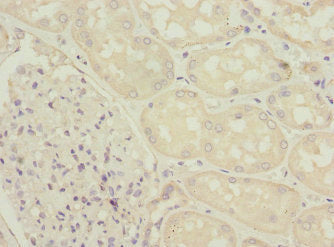 Immunohistochemistry of paraffin-embedded human kidney tissue using the antibody at dilution of 1:100Rabbit anti-Human ZFYVE16 Polyclonal Antibody