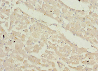 Immunohistochemistry of paraffin-embedded human heart tissue using ZFYVE16 Antibody at dilution of 1:100Rabbit anti-Human ZFYVE16 Polyclonal Antibody