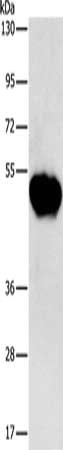 Gel: 8%SDS-PAGE, Lysate: 40 μg, Lane: Human fetal brain tissue, Primary antibody: CHRDL2 Antibody(CHRDL2 Antibody) at dilution 1/600, Secondary antibody: Goat anti rabbit IgG at 1/8000 dilution, Exposure time: 1 minuteRabbit anti-Human CHRDL2 Polyclonal Antibody