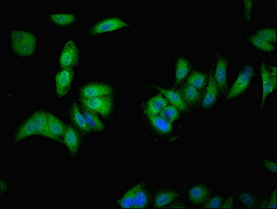 Immunofluorescent analysis of Hela cells using VMO1 Antibody at dilution of 1:100 and Alexa Fluor 488-congugated AffiniPure Goat Anti-Rabbit IgG(H+L)Rabbit anti-Human VMO1 Polyclonal Antibody