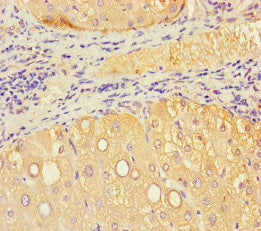 Immunohistochemistry of paraffin-embedded human liver tissue using VMO1 Antibody at dilution of 1:100Rabbit anti-Human VMO1 Polyclonal Antibody
