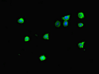 Immunofluorescent analysis of HepG2 cells using MTERF4 Antibody at dilution of 1:100 and Alexa Fluor 488-congugated AffiniPure Goat Anti-Rabbit IgG(H+L)Rabbit anti-Human MTERF4 Polyclonal Antibody