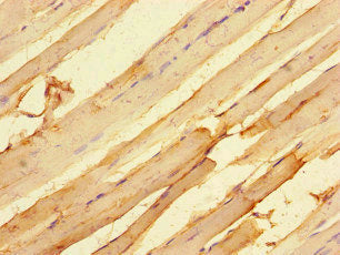 Immunohistochemistry of paraffin-embedded human skeletal muscle tissue using MTERF4 Antibody at dilution of 1:100Rabbit anti-Human MTERF4 Polyclonal Antibody