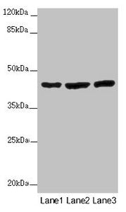 Western blot | All lanes: MTERF4 antibody at 2 μg/ml | Lane 1: Mouse kidney tissue | Lane 2: HL60 whole cell lysate | Lane 3: A549 whole cell lysate | Secondary | Goat polyclonal to rabbit IgG at 1/10000 dilution | Predicted band size: 44 kDa | Observed band size: 44 kDaRabbit anti-Human MTERF4 Polyclonal Antibody