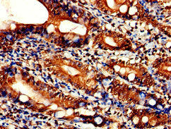 Immunohistochemistry of paraffin-embedded human small intestine tissue using the antibody at dilution of 1:100Rabbit anti-Human TLK2 Polyclonal Antibody