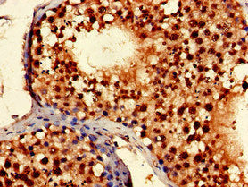Immunohistochemistry of paraffin-embedded human testis tissue using TLK2 Antibody at dilution of 1:100Rabbit anti-Human TLK2 Polyclonal Antibody