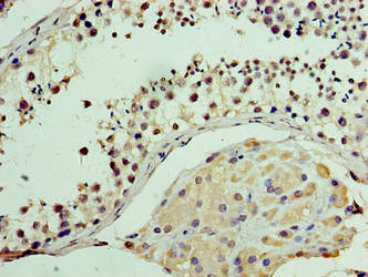 Immunohistochemistry of paraffin-embedded human testis tissue using MON1A Antibody at dilution of 1:100Rabbit anti-Human MON1A Polyclonal Antibody