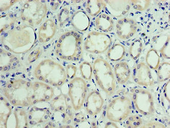 Immunohistochemistry of paraffin-embedded human kidney tissue using MON1A Antibody at dilution of 1:100Rabbit anti-Human MON1A Polyclonal Antibody